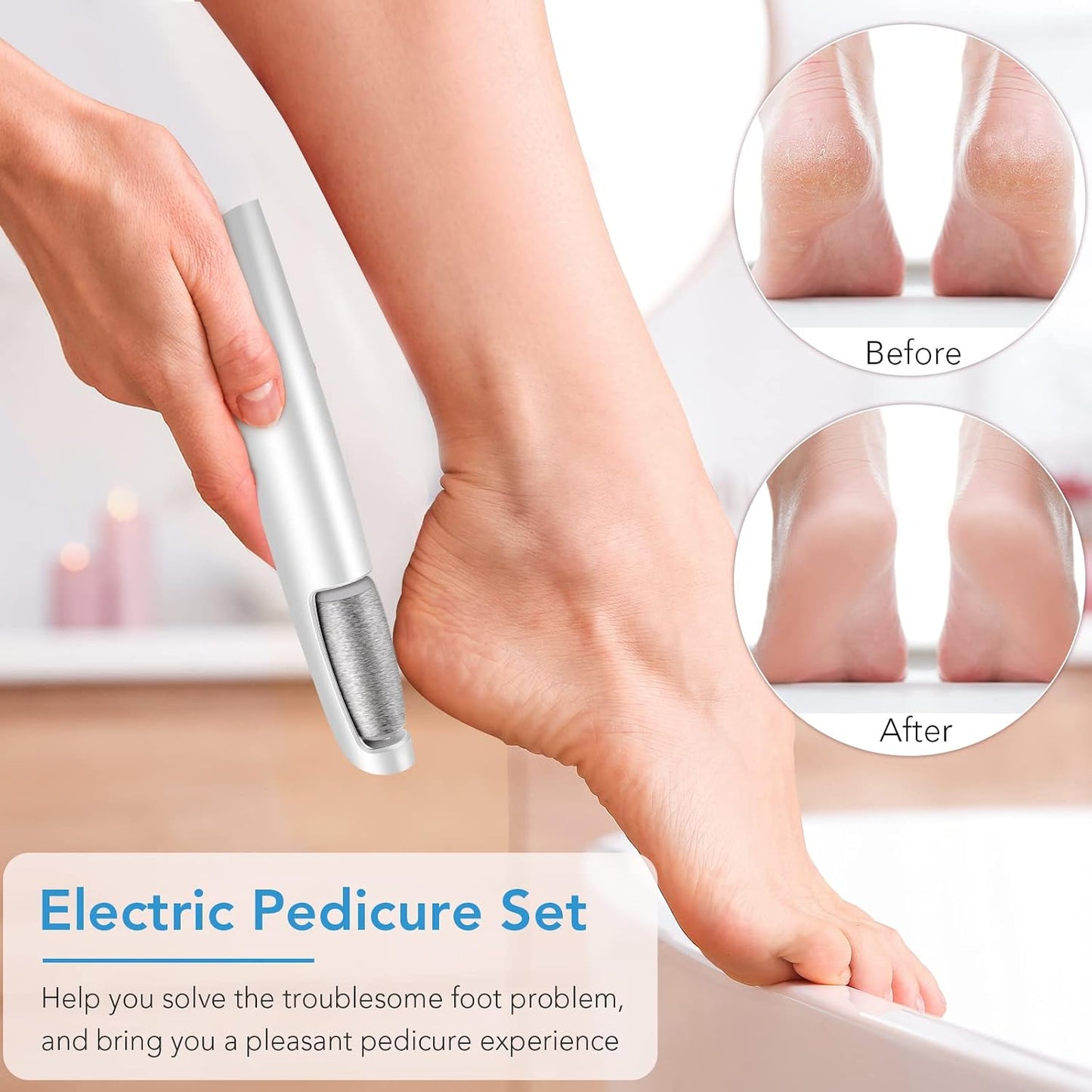 EmergingEra SmoothPro Pulidor Eléctrico de Pies